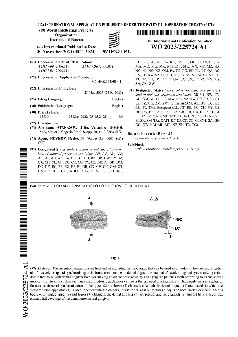 SyncSplint For Aligners WIPO international publication