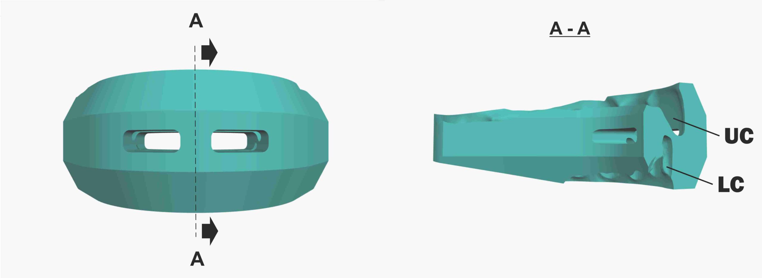 SyncSplint For Aligners patent scheme 02