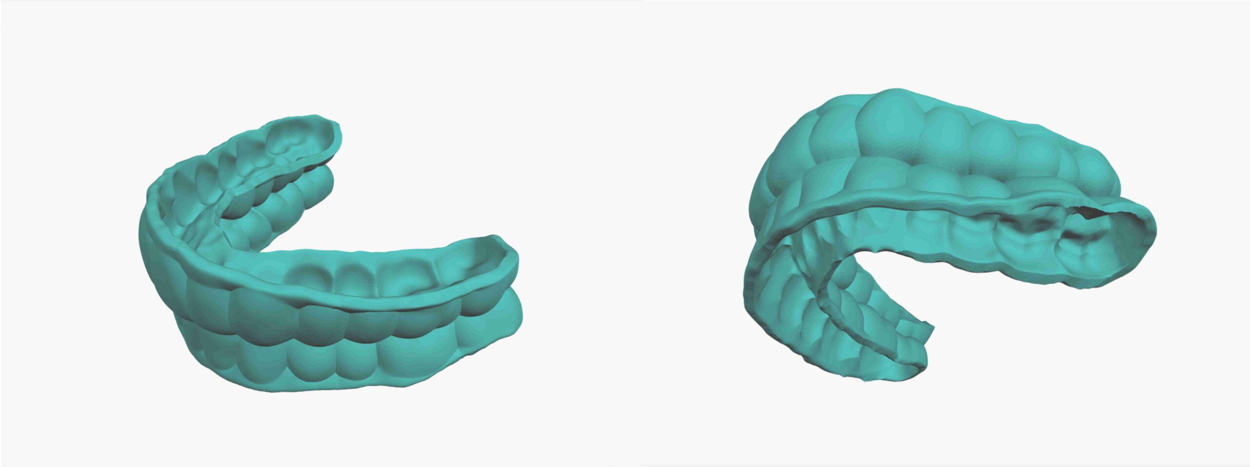 SyncSplint For Aligners patent scheme 06