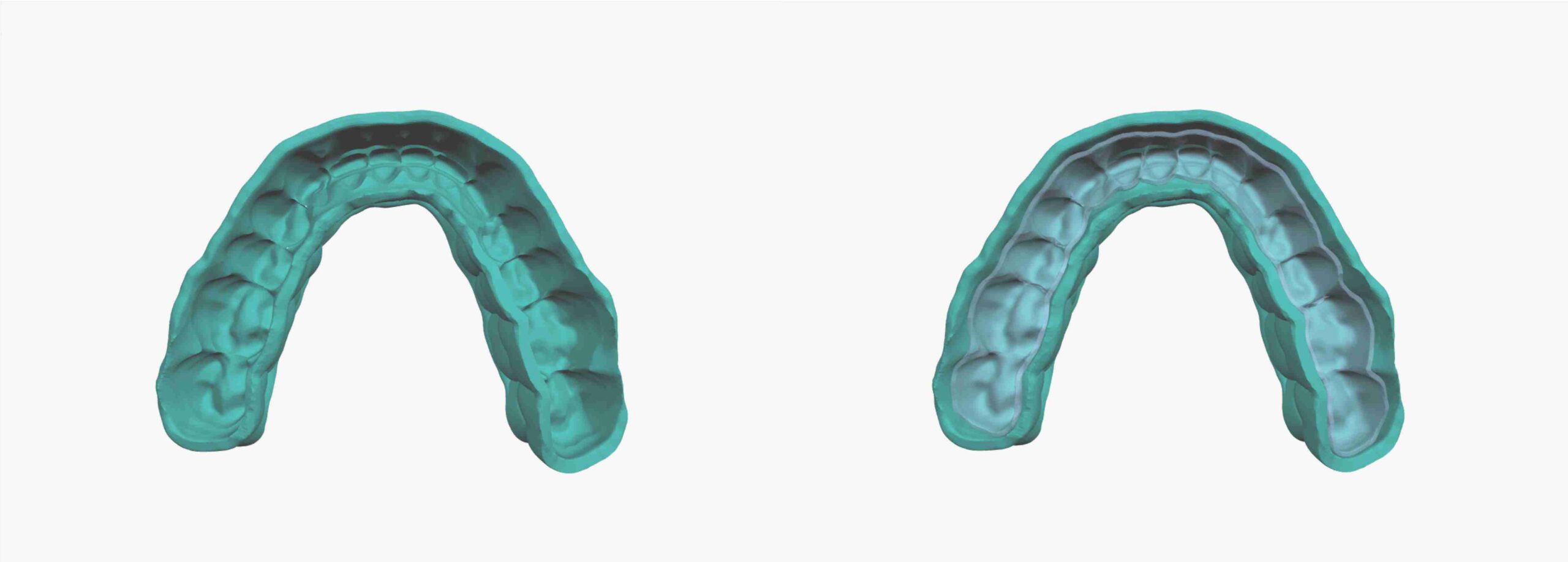 SyncSplint For Aligners patent scheme 04