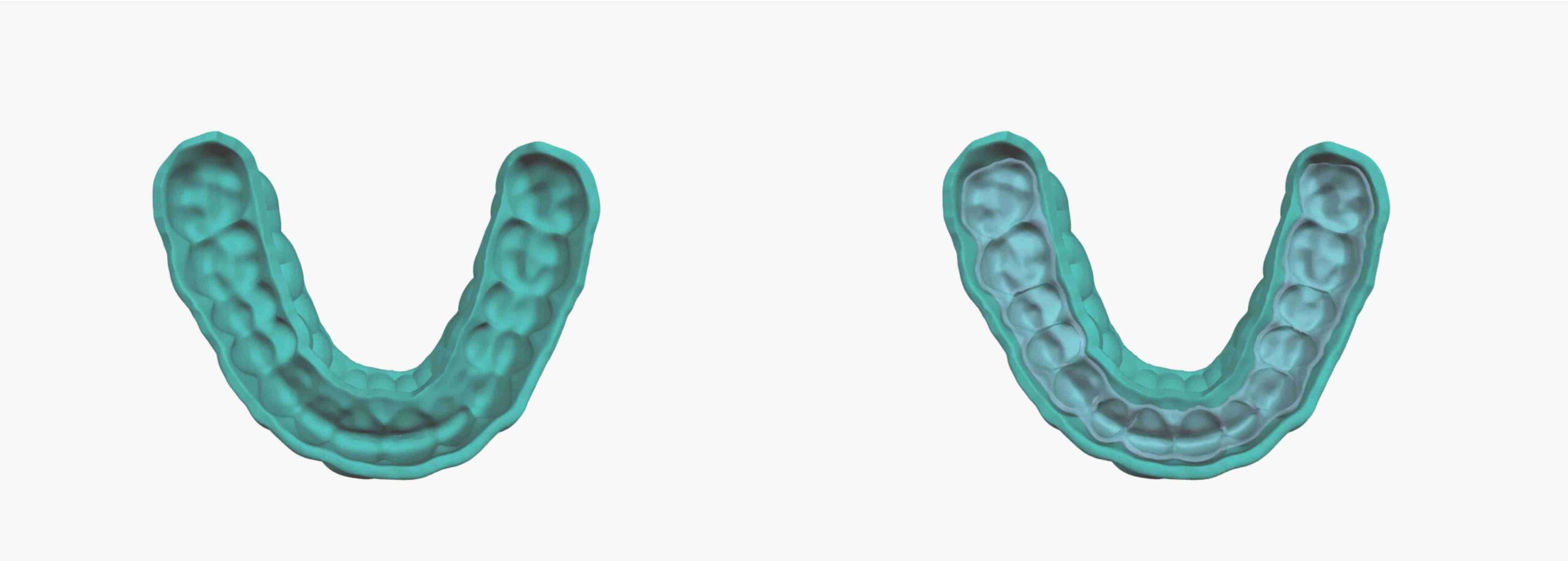 SyncSplint For Aligners patent scheme 03