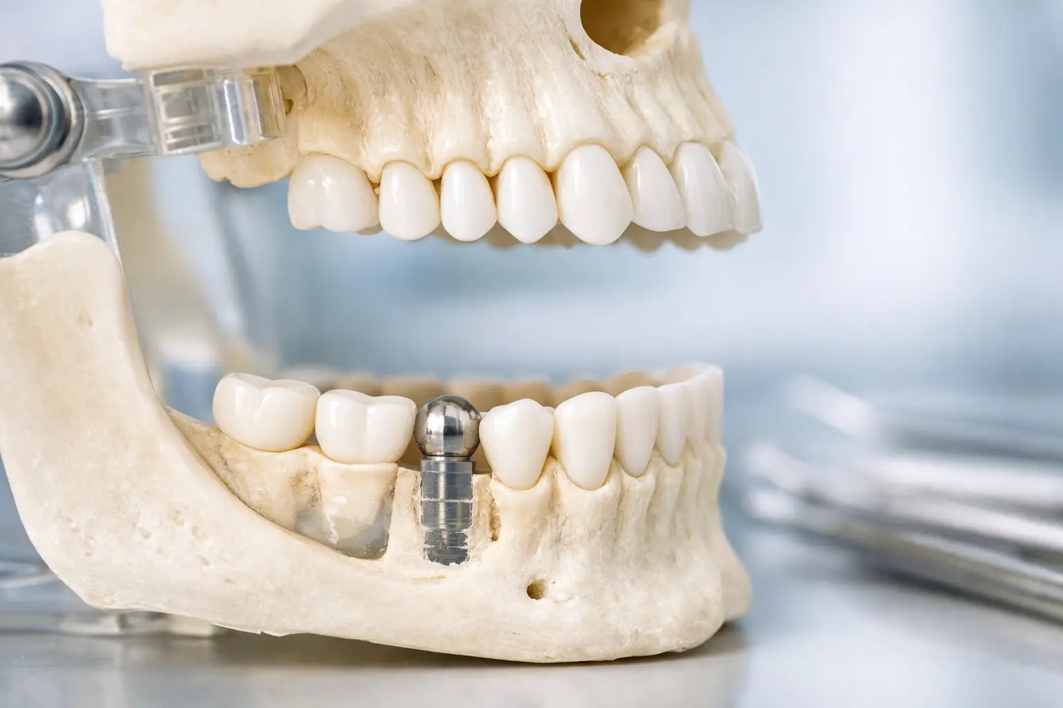 Upper and Lower Jaw Synchronization Explained